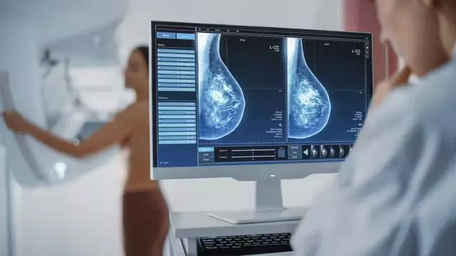 La lucha contra el cáncer acelera para que la supervivencia sea del 70% en 2030