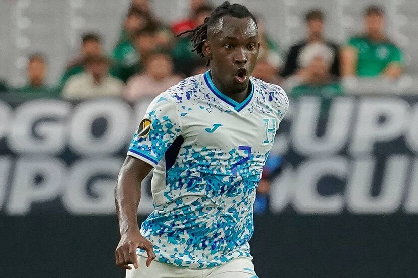 Alberth Elis comienza a mejorar y despierta del coma inducido