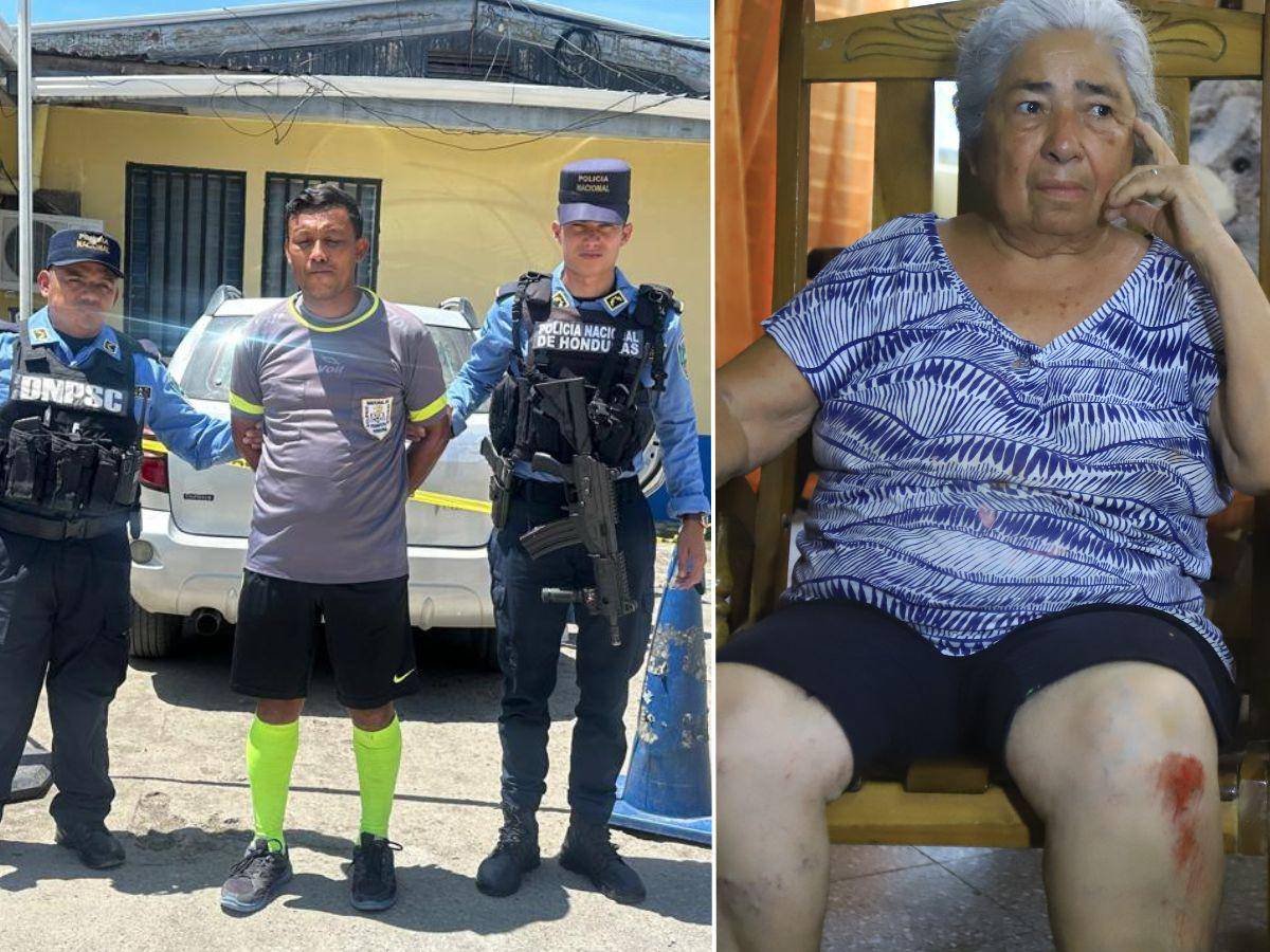 Arbitro que atropelló a adulta mayor queda libre y con medidas sustitutivas