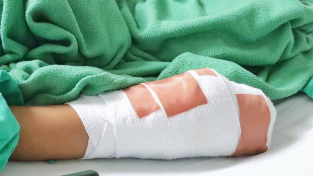 ¡Tragedia! Niño pierde dos de sus dedos tras estallarle un mortero en Choluteca