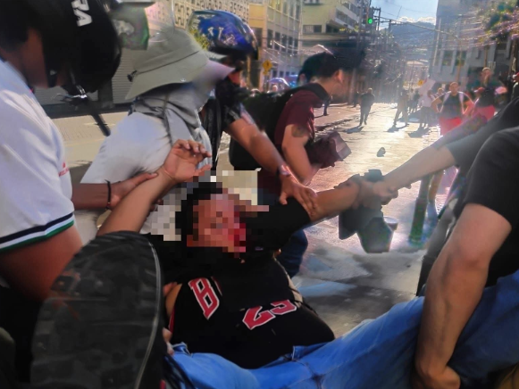 Seguridad ordena investigación por estudiante herido en protesta frente al Congreso
